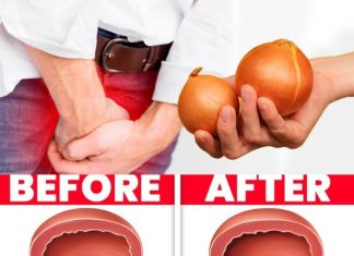 Onion Tea: A Natural Boost for Bladder and Prostate Health