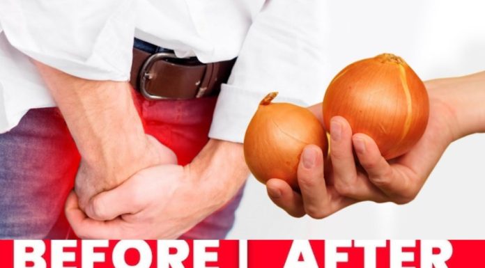 Onion Tea: A Natural Boost for Bladder and Prostate Health