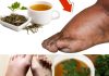 Drink Parsley Tea and Say Goodbye to Swollen Legs, Ankles, and Feet!