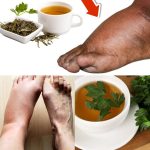 Drink Parsley Tea and Say Goodbye to Swollen Legs, Ankles, and Feet!