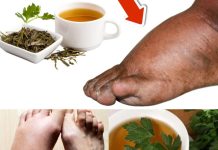 Drink Parsley Tea and Say Goodbye to Swollen Legs, Ankles, and Feet!
