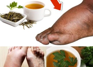 Drink Parsley Tea and Say Goodbye to Swollen Legs, Ankles, and Feet!