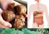 Taro (Colocasia esculenta): The Secret to Digestive and Colon Health