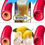 Clear Your Arteries with This Simple Juice – A Natural Remedy for Better Circulation