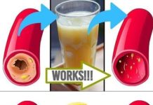Clear Your Arteries with This Simple Juice – A Natural Remedy for Better Circulation