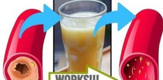 Clear Your Arteries with This Simple Juice – A Natural Remedy for Better Circulation