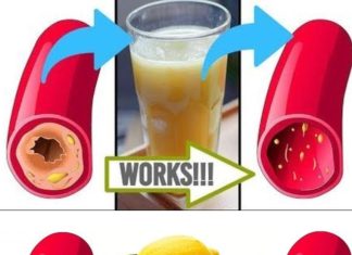 Clear Your Arteries with This Simple Juice – A Natural Remedy for Better Circulation