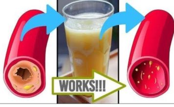 Clear Your Arteries with This Simple Juice – A Natural Remedy for Better Circulation