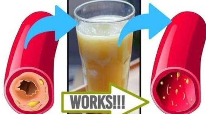 Clear Your Arteries with This Simple Juice – A Natural Remedy for Better Circulation