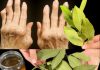 Apply Bay Leaves to Your Joints: Feel the Difference in Just a Week!