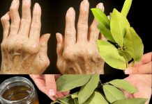 Apply Bay Leaves to Your Joints: Feel the Difference in Just a Week!
