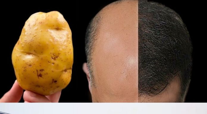 Revive Your Hair Naturally: The Magic of Potatoes
