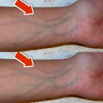 5 Warning Signs of Poor Circulation You Should NEVER Overlook 💥 (IMPORTANT)