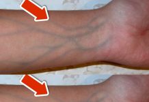 5 Warning Signs of Poor Circulation You Should NEVER Overlook 💥 (IMPORTANT)