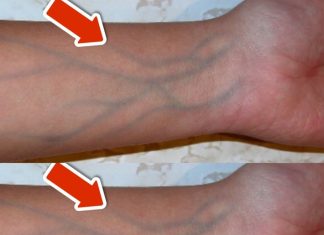 5 Warning Signs of Poor Circulation You Should NEVER Overlook 💥 (IMPORTANT)