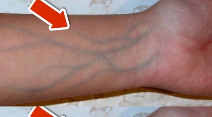 5 Warning Signs of Poor Circulation You Should NEVER Overlook 💥 (IMPORTANT)