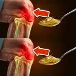 Eliminate Joint Pain for 20 Years with This Simple Trick! 💥 (Unfortunately Secret)