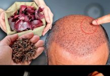 The Surprising Hair Growth Benefits of Cloves and Onion Peels