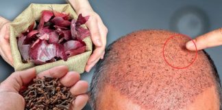 The Surprising Hair Growth Benefits of Cloves and Onion Peels