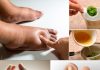 The Best Herbal Tea for Swollen Legs: A Natural Remedy for Fluid Retention