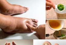 The Best Herbal Tea for Swollen Legs: A Natural Remedy for Fluid Retention