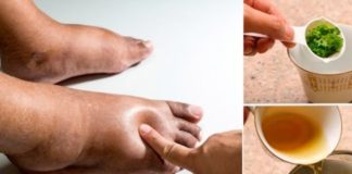 The Best Herbal Tea for Swollen Legs: A Natural Remedy for Fluid Retention