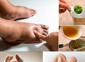 The Best Herbal Tea for Swollen Legs: A Natural Remedy for Fluid Retention