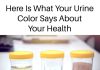 What Your Urine Color Says About Your Health