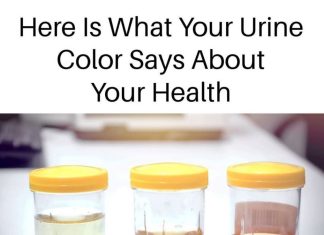 What Your Urine Color Says About Your Health