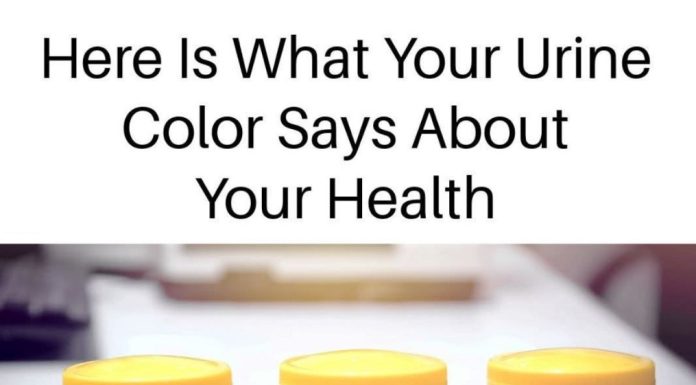 What Your Urine Color Says About Your Health