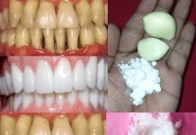 Teeth Whitening at Home in 2 Minutes! Naturally Whiten Yellow Teeth with Garlic & Salt (100% Effective!)