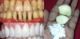 Teeth Whitening at Home in 2 Minutes! Naturally Whiten Yellow Teeth with Garlic & Salt (100% Effective!)