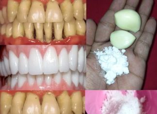 Teeth Whitening at Home in 2 Minutes! Naturally Whiten Yellow Teeth with Garlic & Salt (100% Effective!)
