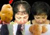 Hair Grows Like Crazy and Doesn’t Fall Out! Discover the Powerful Potato Recipe