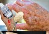Coconut oil and baking soda based scrub