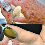 Coconut oil and baking soda based scrub