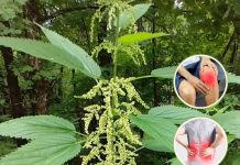 Nettle: The Natural Super Remedy for 20 Common Health Issues
