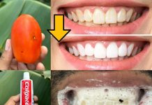 Say Goodbye to Yellow Teeth with This Natural Recipe! Get Whiter Teeth in Just Minutes Without Spending Money at the Dentist