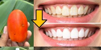 Say Goodbye to Yellow Teeth with This Natural Recipe! Get Whiter Teeth in Just Minutes Without Spending Money at the Dentist