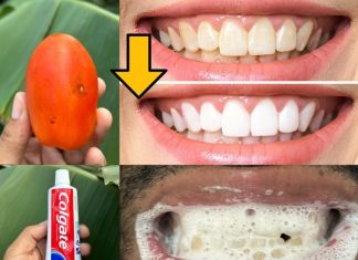 Say Goodbye to Yellow Teeth with This Natural Recipe! Get Whiter Teeth in Just Minutes Without Spending Money at the Dentist