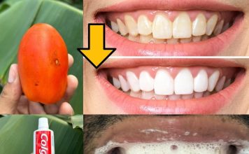Say Goodbye to Yellow Teeth with This Natural Recipe! Get Whiter Teeth in Just Minutes Without Spending Money at the Dentist