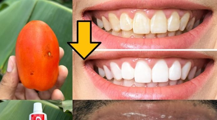 Say Goodbye to Yellow Teeth with This Natural Recipe! Get Whiter Teeth in Just Minutes Without Spending Money at the DentistÂ