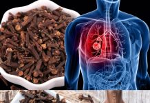 How to Use Cloves to Fight Respiratory Infections and Bronchitis