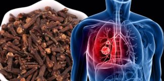 How to Use Cloves to Fight Respiratory Infections and Bronchitis