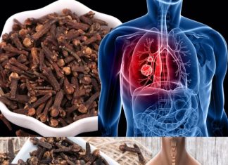How to Use Cloves to Fight Respiratory Infections and Bronchitis