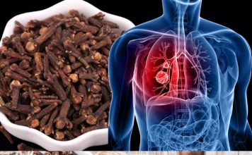 How to Use Cloves to Fight Respiratory Infections and Bronchitis