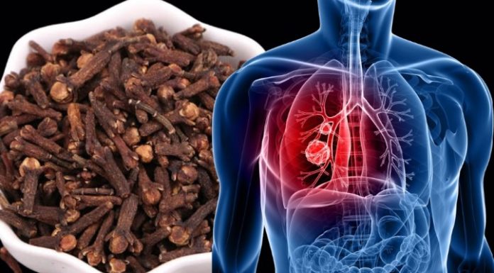 How to Use Cloves to Fight Respiratory Infections and Bronchitis