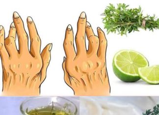 Thyme and Lemon: A Natural Remedy for Arthritis and Inflammation