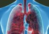 The Highland Flower: A Natural Ally in Quitting Smoking
