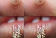 BE VERY CAREFUL . If you get this, you are infected with